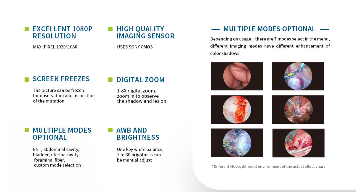 FHD Endoscopic Imaging Equipment,full HD medical endoscope,Laparoscope